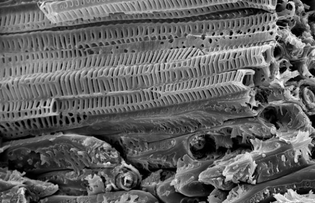 Sistema vascular del endocarpio